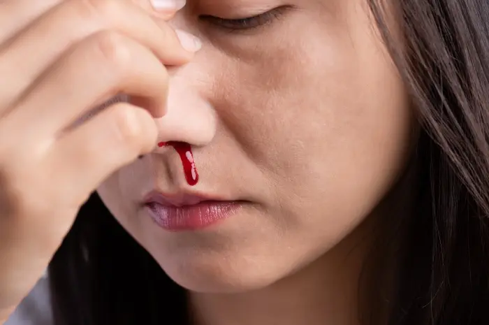 Mengatasi dan Mencegah Mimisan: Penyebab, Pencegahan, dan Tips Perawatan Mandiri